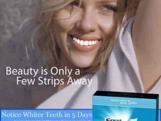 Get Professional Tooth Whitening Strips Online	